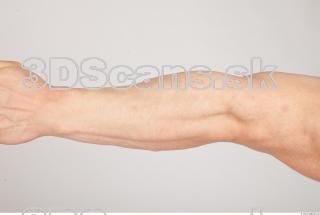 Forearm texture of Gene 0001